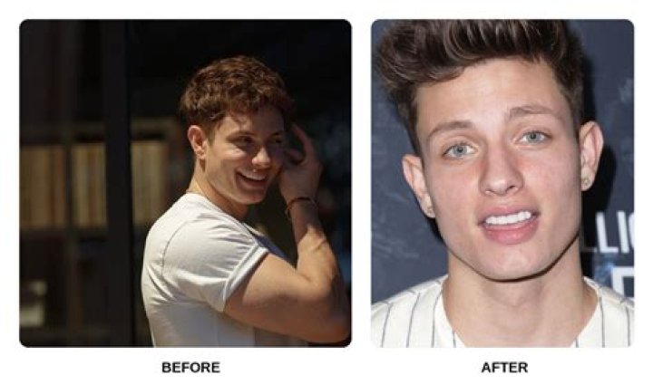 Are Matt Rife's Teeth Real? The Comedian's Choppers Are Just Too Perfect