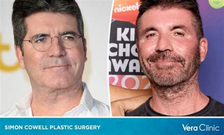 Simon Cowell undergoes surgery after breaking back while at home with